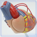 Modèle de coeur humain en plastique d&#39;athérosclérose de vente chaude de PNT-0400a